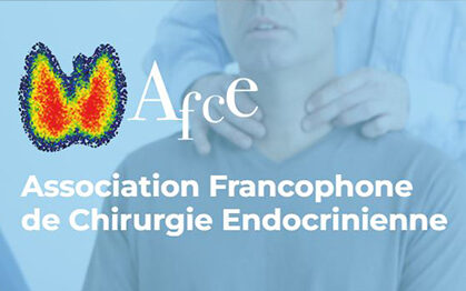 afce
