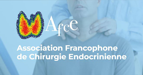 afce