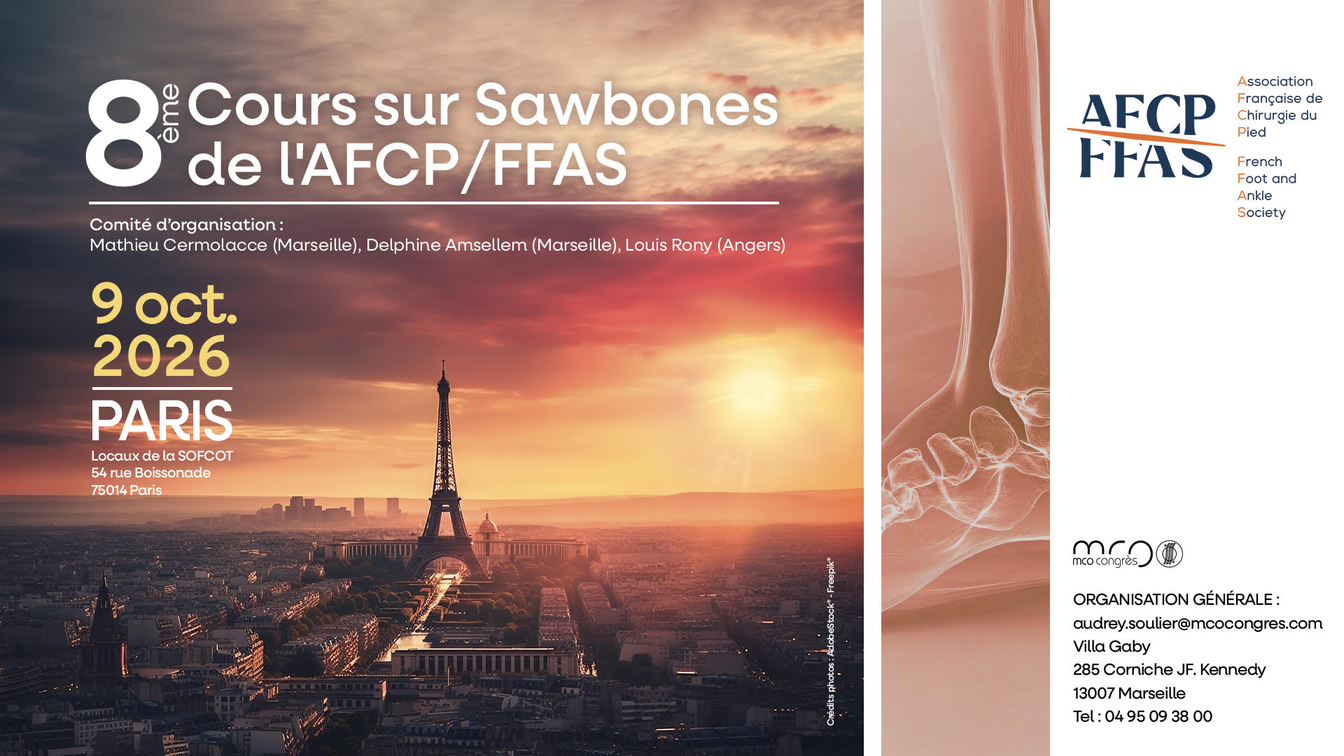 sawbones afcp